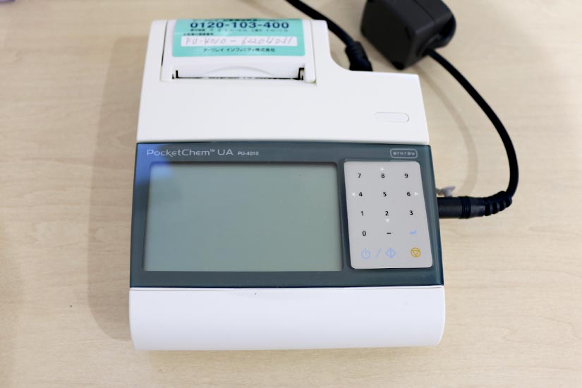 小型尿分析装置